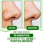 (Oferta especial) 🎁 Lanbena®: Mascarilla avanzada para puntos negros