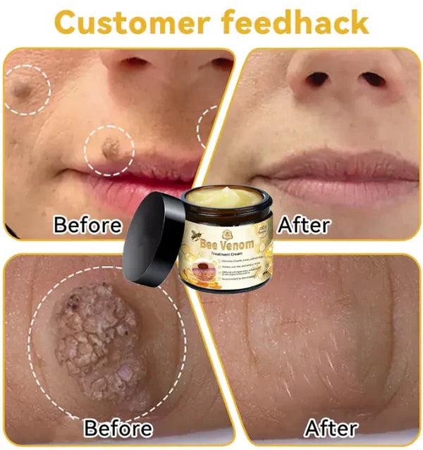 🌿Bee Venom Cream ✨¡Elimina una amplia gama de problemas de la piel