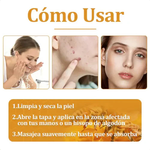 🌿Bee Venom Cream ✨¡Elimina una amplia gama de problemas de la piel